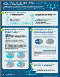 Early lung cancer screen saves lives infographic Early lung cancer screen saves lives infographic