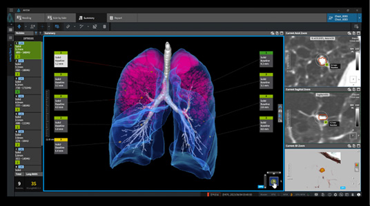 aview:LCS interface