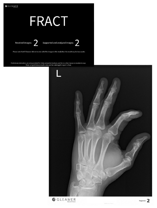 BoneView 1.1-US interface