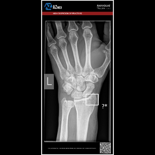 AZMed Rayvolve Trauma interface
